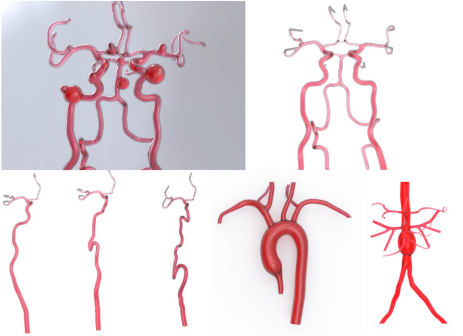 定制心血管脉管模型