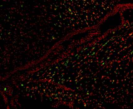 Stellaris in Tissue