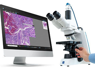 microscope upgrade digital pathology