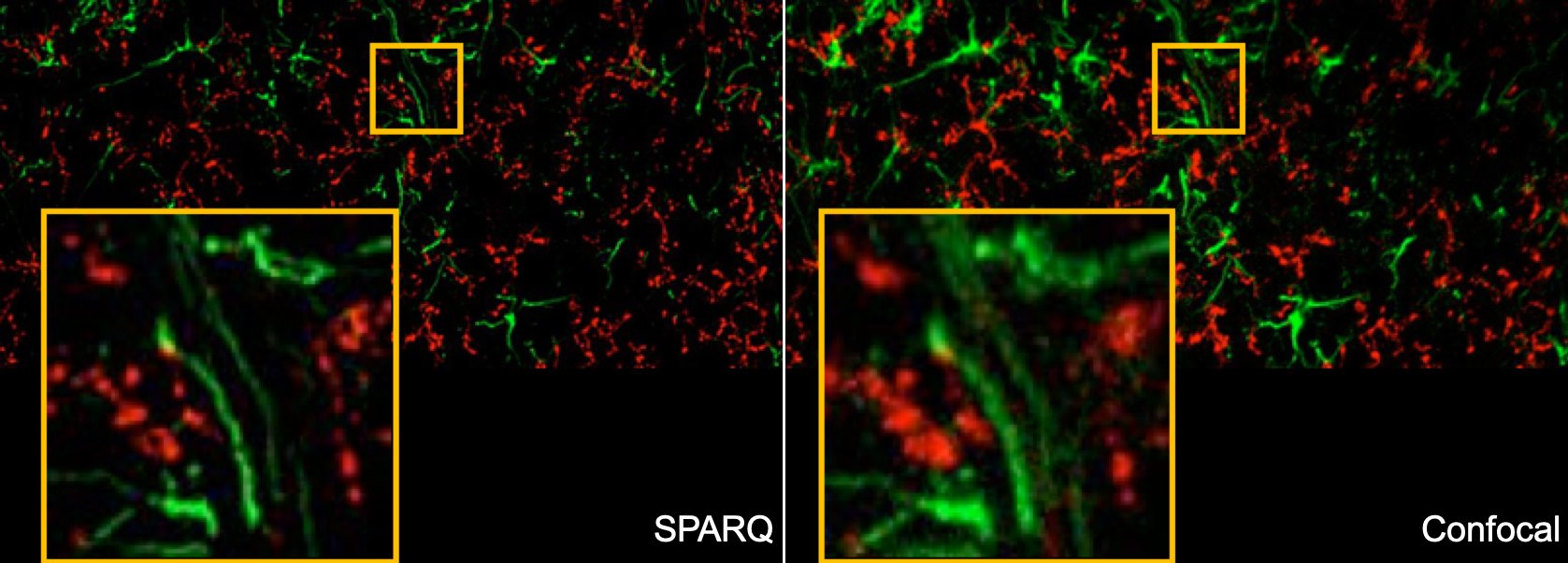 comparaison sparq vs confocal